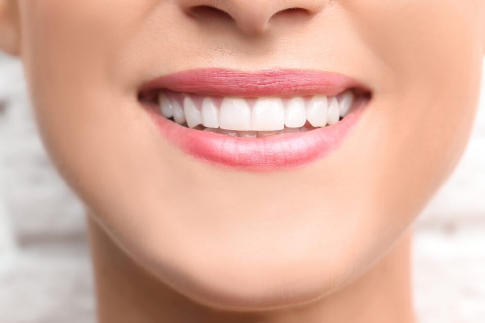Cosmetic Bonding Cost: How Much Should You Pay for a Perfect Smile?