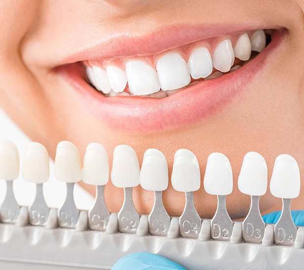 Delray Beach Cosmetic Dentist: Enhance Your Smile Today!