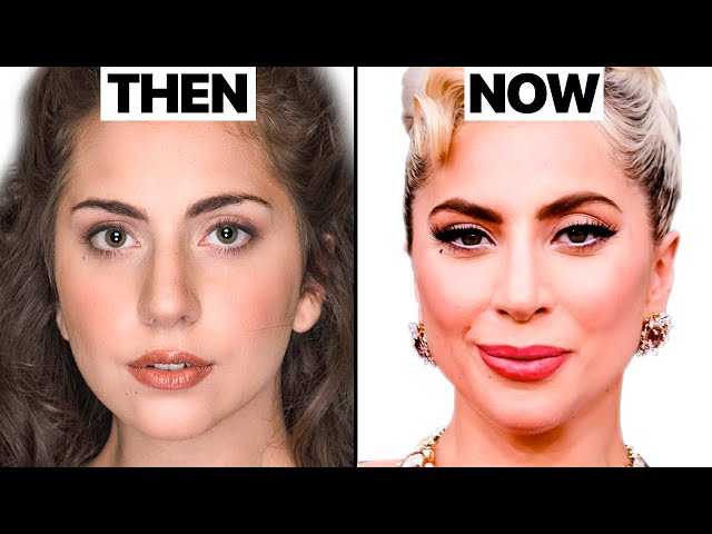 Has Lady Gaga Had Cosmetic Surgery? Simple Truths About Gagas Looks!